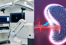 Photo of दिल्ली: एम्स ने देश का पहला रोबोटिक किडनी ट्रांसप्लांट किया