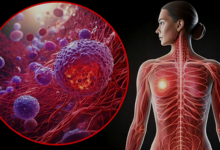 Photo of हाई-फैट कीटो आहार बढ़ा सकती है ब्रेस्ट कैंसर का खतरा