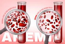 Photo of ये चार गलतियां बढ़ा देती हैं एनीमिया का खतरा