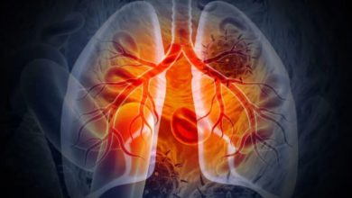 Photo of फेफड़ों के कैंसर के खिलाफ बड़ी कामयाबी! जाने केसे