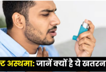 Photo of बचपन वाले अस्थमा से भी ज्यादा खतरनाक है एडल्ट ऑनसेट अस्थमा