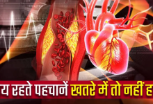 Photo of डायबिटीज के मरीज ध्यान दें: रूटीन चेकअप में शामिल करें यह एक टेस्ट