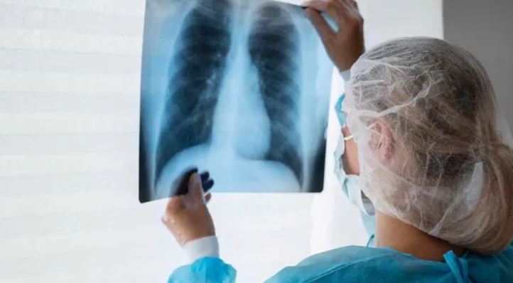 Photo of कमजोर इम्युनिटी और खराब जीवनशैली दे रही टीबी को न्योता