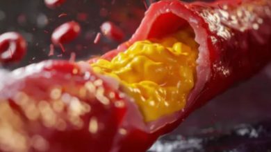 Photo of क्या बिना किसी लक्षण के शरीर में बढ़ सकता है कोलेस्ट्रॉल? 