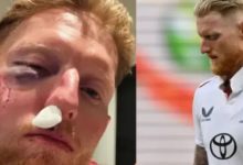 Photo of इंग्लैंड के कप्तान बेन स्टोक्स के चेहरे पर लगी भयानक चोट