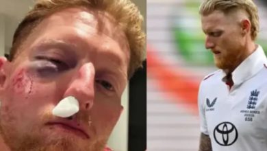 Photo of इंग्लैंड के कप्तान बेन स्टोक्स के चेहरे पर लगी भयानक चोट