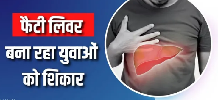 Photo of क्यों 20-25 साल के युवा भी हो रहे हैं फैटी लिवर का शिकार