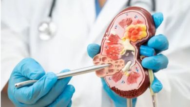 Photo of किडनी डिजीज को साइलेंट किलर क्यों कहा जाता है?